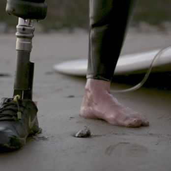 Achilles Prosthetics & Orthotics - Orthotics Near Me - Santa Maria, California Achilles Prosthetics & Orthotics - Orthotics Near Me - Santa Maria, California