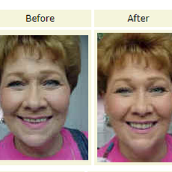 The Denture Studio