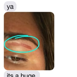 Style Nails & Spa - Burned eyebrow area