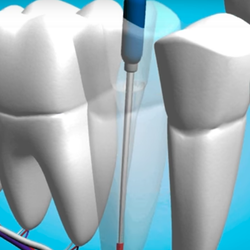 Mark W Johnson, DDS