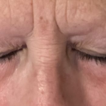 Rico Skin Co. - Before~ literally no eyebrows - Permanent Makeup Near Me - Long Beach, California Rico Skin Co. - Before~ literally no eyebrows - Permanent Makeup Near Me - Long Beach, California
