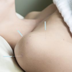 Golden Proportion Acupuncture - Chinese Acupuncture
Acupuncture
Chinese Medicine
Pain Management
Stress Relief
Anxiety Relief