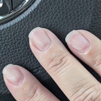 XOXO Nail Bar - Dry brittle fingernails from that long acetone soak - Nail Salons Near Me - Irvine, California XOXO Nail Bar - Dry brittle fingernails from that long acetone soak - Nail Salons Near Me - Irvine, California