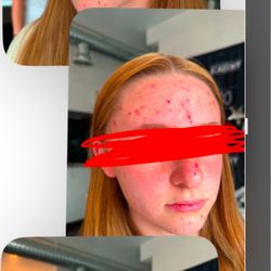The Secret Garden Salon & Spa - They tortured her. She said it hurt and the "lash lady" continued to cut her skin! Shame on them all.