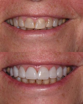 Hollywood Family Dentistry