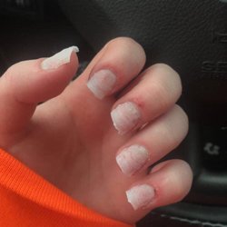 Magic Nails - Physically caused a customer to bleed , aswell as her husband who cut her nails so short it bled , then put chemicals on the wound.