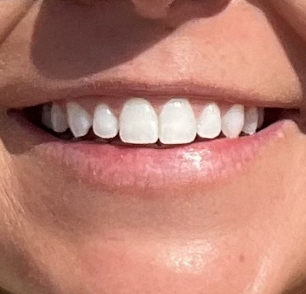 GLOW UP AESTHETICS Updated September 2024 15 Photos 4506 W Main