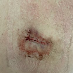 Premier Dermatology