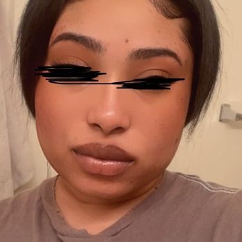 Beauty By Thread - This was day 1 after getting my full face threaded - Hair Removal Near Me - Sacramento, California Beauty By Thread - This was day 1 after getting my full face threaded - Hair Removal Near Me - Sacramento, California