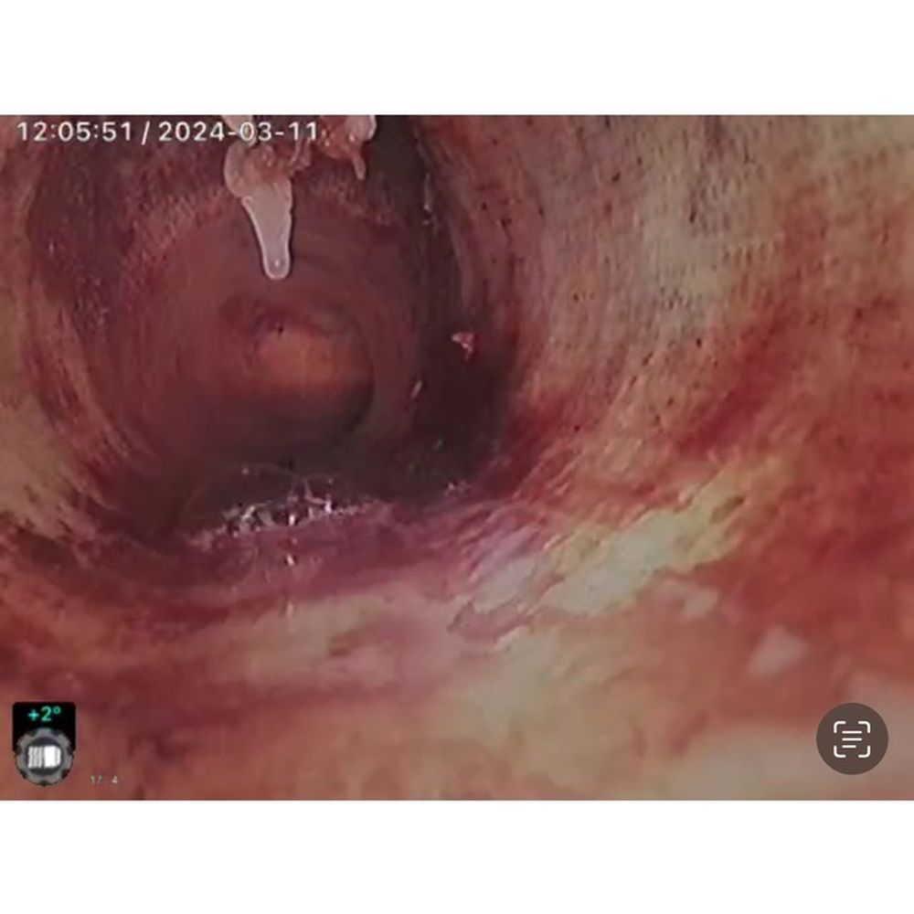 Professional Trenchless Repair - Lined cast iron where rough edges were left that is catching toilet paper and created blockages - Plumbing Near Me - Miami, Florida Professional Trenchless Repair - Lined cast iron where rough edges were left that is catching toilet paper and created blockages - Plumbing Near Me - Miami, Florida