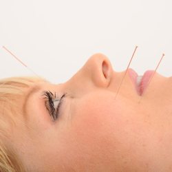 Los Altos Women's Acupuncture Clinic