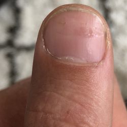 Le Nails - That's not polish, this is how nail nail is reacting to the hack job! DO NOT GO HERE