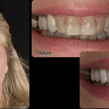 Kelly Blair Cosmetic and Restorative Dentistry - General Dentistry Near Me - Forth Worth, Texas Kelly Blair Cosmetic and Restorative Dentistry - General Dentistry Near Me - Forth Worth, Texas