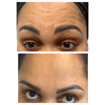 Laymuna Beauty - Botox - Skin Care Near Me - Denver, Colorado Laymuna Beauty - Botox - Skin Care Near Me - Denver, Colorado