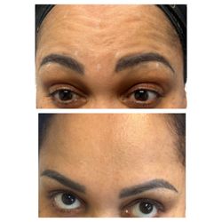 Laymuna Beauty - Botox