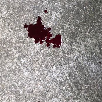 All Tails Are Wagging Pet Grooming - Blood dripping from my dog after being cut at All Tails Wagging - Pet Groomers Near Me - West Warwick, Rhode Island All Tails Are Wagging Pet Grooming - Blood dripping from my dog after being cut at All Tails Wagging - Pet Groomers Near Me - West Warwick, Rhode Island