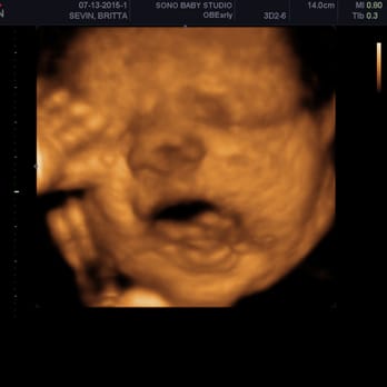 Sono Baby Studio - Diagnostic Imaging Near Me - New York, New York Sono Baby Studio - Diagnostic Imaging Near Me - New York, New York