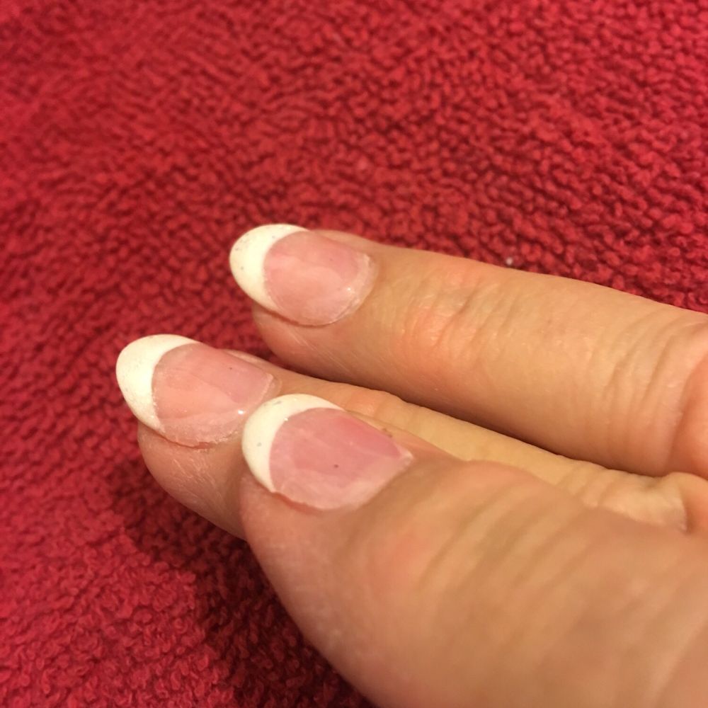 Athena Nail Boutique - A week later, all the edges of the acrylic dip have lifted up. - Nail Salons Near Me - Albuquerque, New Mexico