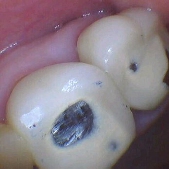 West Dental Care - General Dentistry Near Me - Roanoke, Texas West Dental Care - General Dentistry Near Me - Roanoke, Texas