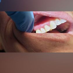 Valley Endodontics & Oral Surgery