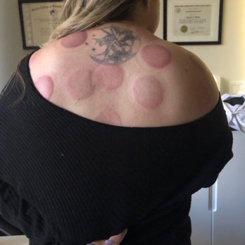 Massage SoCal - Massage Near Me Massage SoCal - Massage Near Me