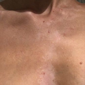 SUGARED + BRONZED - Hair Removal Near Me - New York, New York