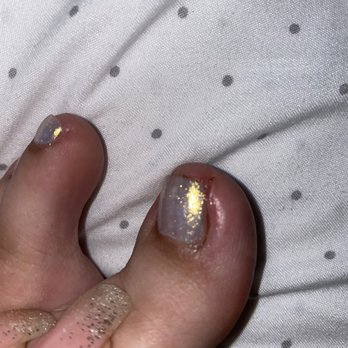 Angel's Nail - Bad cut and blood - Nail Salons Near Me - Los Angeles, California