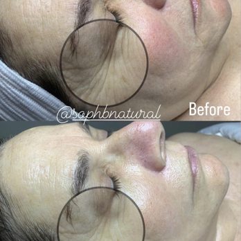 SophBNatural - Firming and tightening mask - Estheticians Near Me - Sacramento, California SophBNatural - Firming and tightening mask - Estheticians Near Me - Sacramento, California