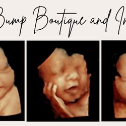 The Bump Boutique & Imaging - Some of our little cuties!