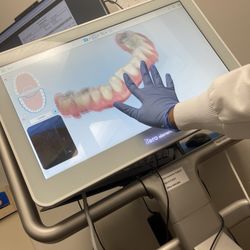 College Park Dental - Her moving around and inspecting my 3D image of my teeth. Blurry on the ends because it's in movement here.
