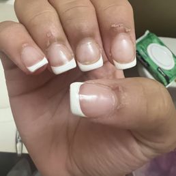 Hang nails