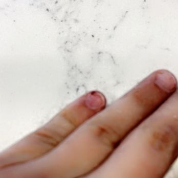 Mk Exotic Nails - My bleeding nail!! - Nail Salons Near Me - Orlando, Florida Mk Exotic Nails - My bleeding nail!! - Nail Salons Near Me - Orlando, Florida