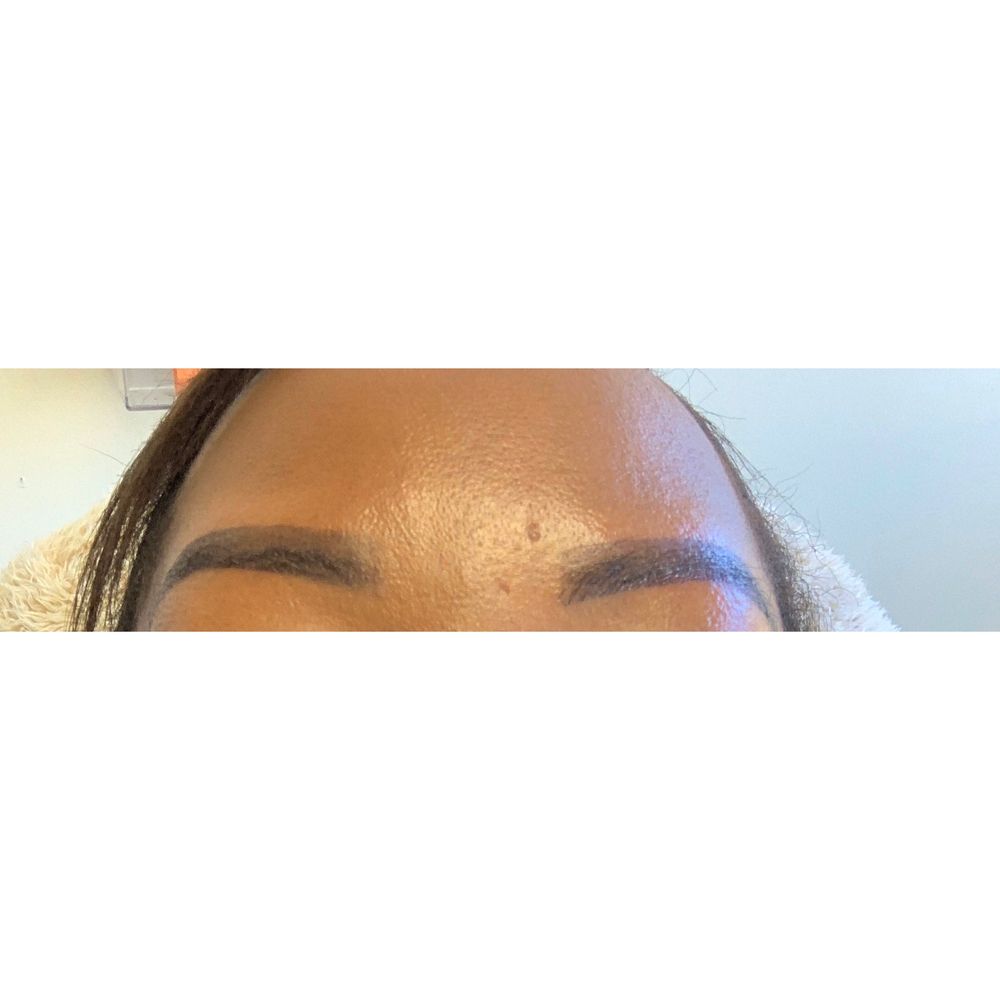 Platinum Esthetics - After - Teeth Whitening Near Me - Danbury, Connecticut Platinum Esthetics - After - Teeth Whitening Near Me - Danbury, Connecticut