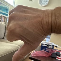 Thumbs down