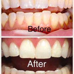 Smiles of Chandler - After just 11 months of treatment with Dr. Heaton! Love the wonderful staff & dr's there!