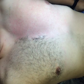 Iridescence Aesthetics - Men's chest waxing available here! - Waxing Near Me - Pflugerville, Texas Iridescence Aesthetics - Men's chest waxing available here! - Waxing Near Me - Pflugerville, Texas