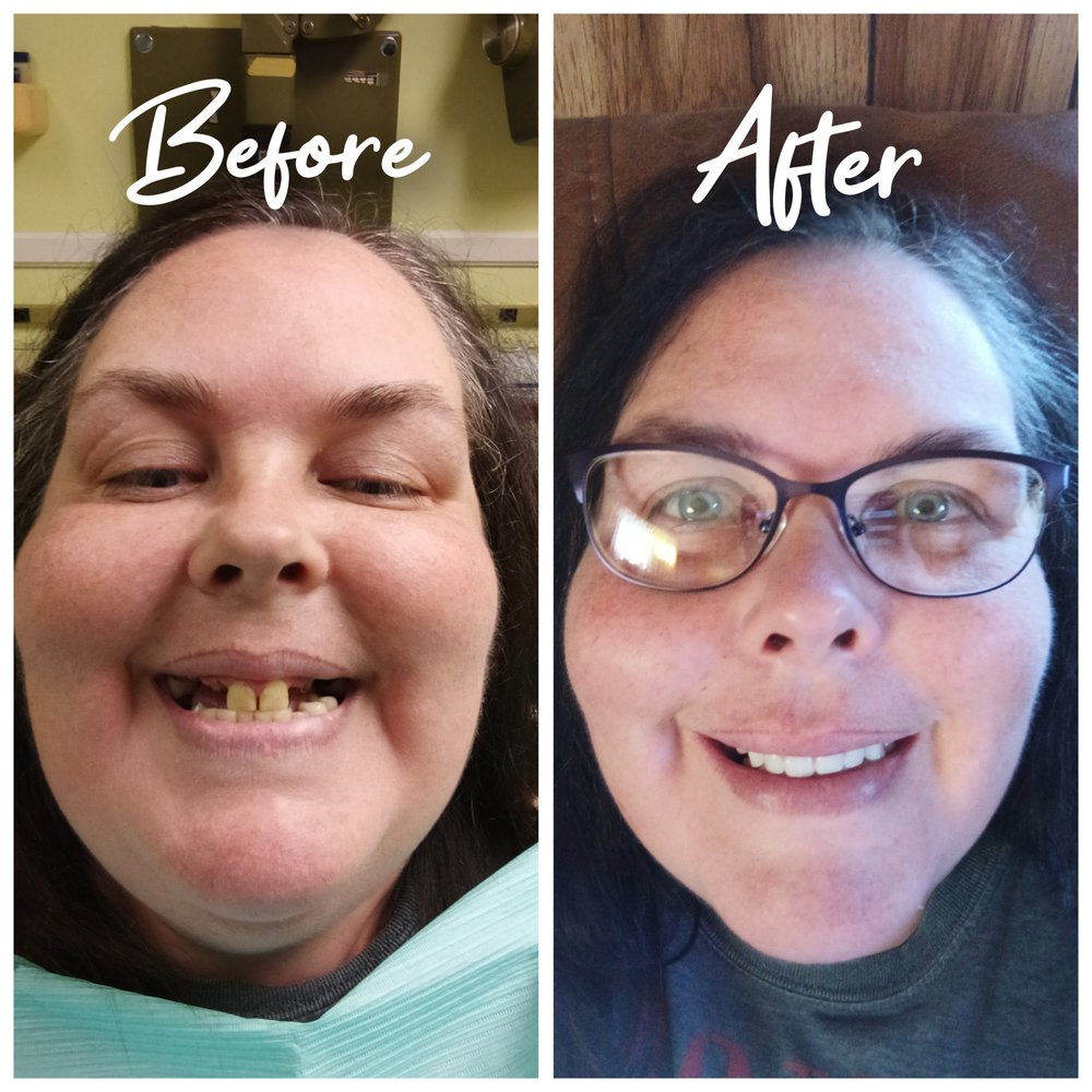 BIG RIDGE FAMILY AND COSMETIC DENTISTRY Updated June 2024 5606