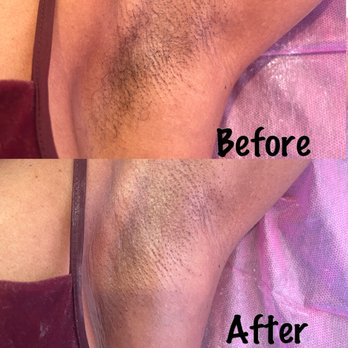 Wax It - Underarm wax - Waxing Near Me - Studio City, California Wax It - Underarm wax - Waxing Near Me - Studio City, California