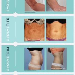 Advanced Body Sculpting and Medspa