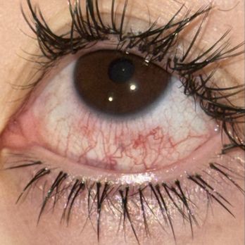 Lash With Me - Eye infections for longer than 4 days - Eyelash Service Near Me - Fullerton, California