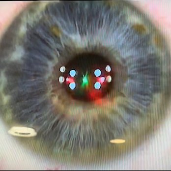 NVISION Eye Centers - Torrance - Ophthalmologists Near Me - Torrance, California