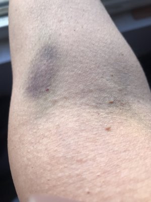 QUEST DIAGNOSTICS - Updated January 2025 - 47 Photos & 90 Reviews (2.8