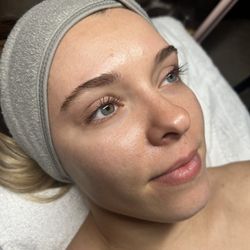 Natalie Manseau Esthetician - Post Glow After Dermaplane Facial