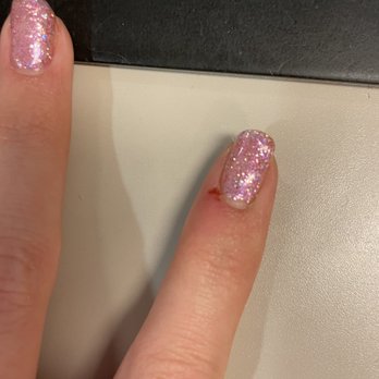 Gel Touch Nail Spa - Cut finger and damaged nails - Nail Salons Near Me - Carlsbad, California Gel Touch Nail Spa - Cut finger and damaged nails - Nail Salons Near Me - Carlsbad, California