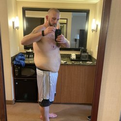 Shahram Salemy, MD - This was the day before surgery. Side