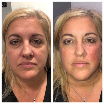 Bellissima Medical Spa - Medical Spas Near Me - Long Beach, California