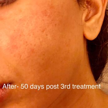 Phoenix Skin Spa - Medical Spas Near Me - Phoenix, Arizona