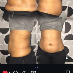 Slim and Sculpt Aesthetics