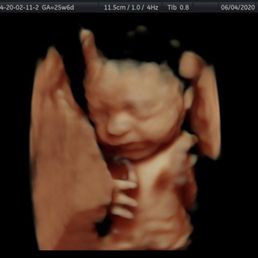 Baby boy at 26 weeks