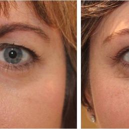 Before and after Before and after